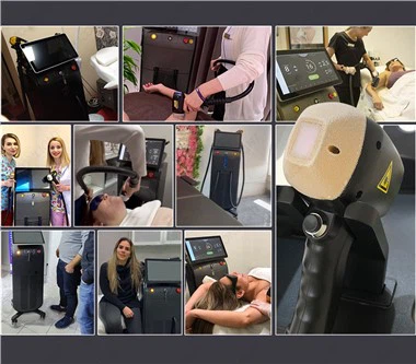 Diodinis plaukų šalinimo lazeriu aparatas su nuolaida