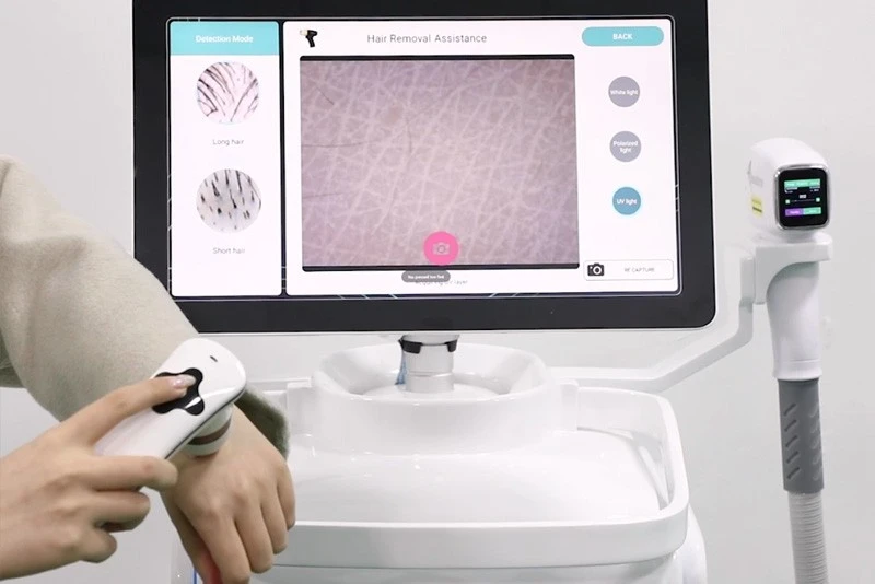 AI-Powered Laser Hair Removal Machines best