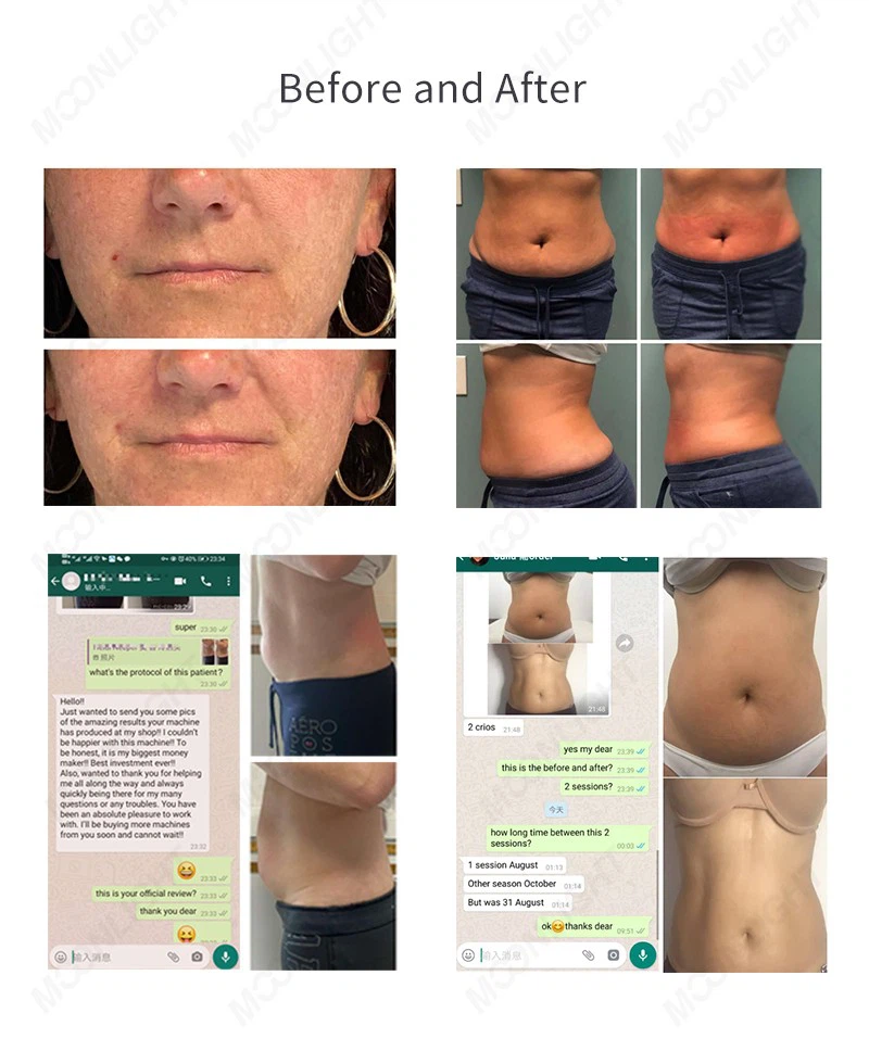 Cryoskin 4.0 Machine – Advanced Cold & Heat Body Contouring Technology price