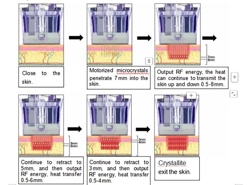 Crystallite Depth 8 RF Microneedling Machine suppliers