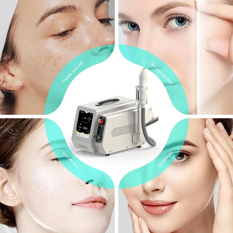 Desktop Tattoo Removal Machine