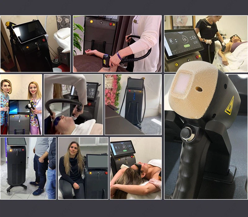 MNLT Advanced Diode Laser Hair Removal Machine