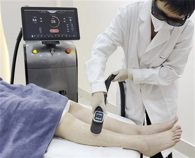 5 geriausi profesionalios lazerinės plaukų šalinimo mašinos